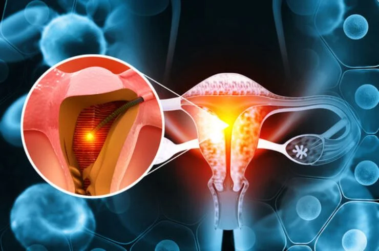 Dilation & Curettage (D&C)