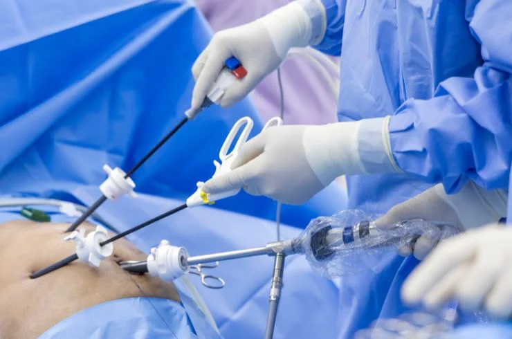 Laparoscopic Surgeries